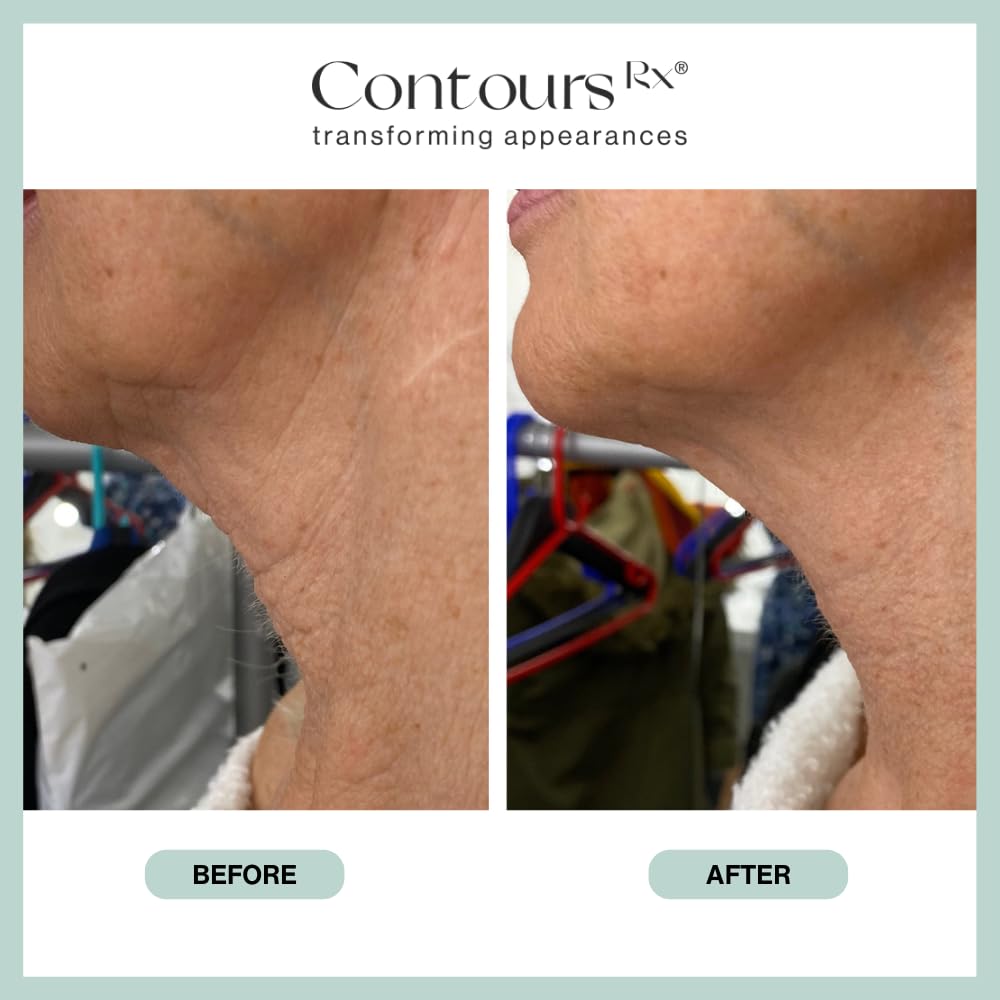 Contours Rx Neck Rescue long-hold strips sustain a secure wear for hours.