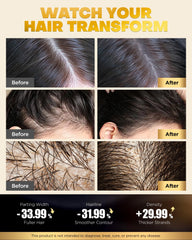 COOLKESI Rosemary Onion scalp-clarity scene shows balanced roots and refreshed cleanse.