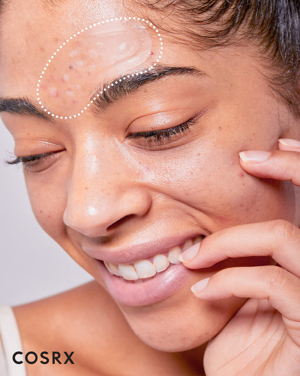 COSRX Master Patch Intensive clear-matte edge blends discreetly for blemish care