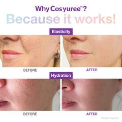 Cosyuree Collagen Spicule Serum dropper detail highlighting micro spicules
