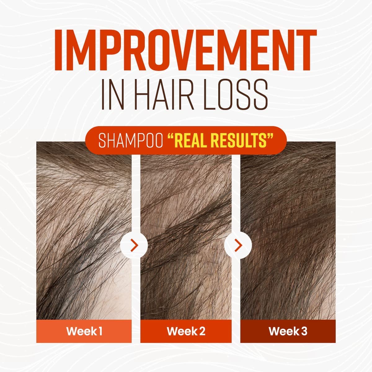 CRAZY SKIN Beers Yeast Shampoo lather delivers refreshing cleanse for scalp comfort