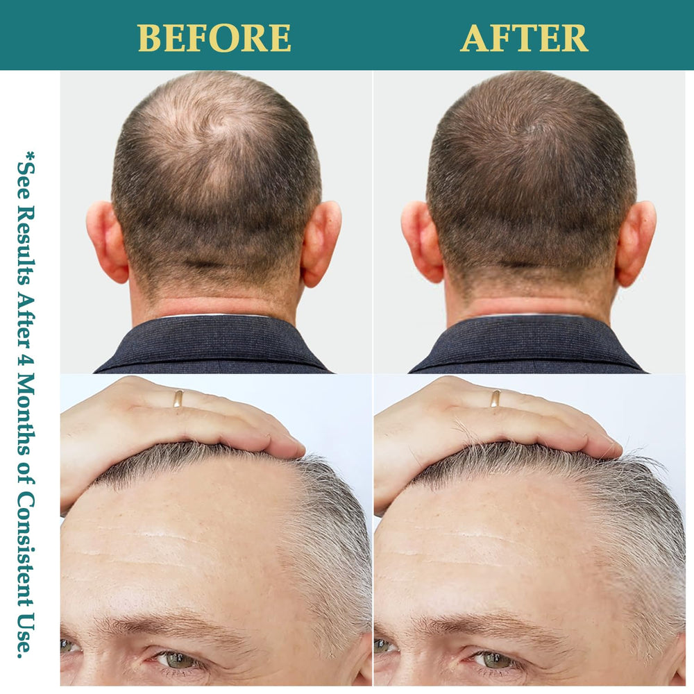 Creip Biotin Caffeine Complex highlighting boost for hair vitality and fullness options