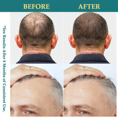 Creip Biotin Caffeine Complex highlighting boost for hair vitality and fullness options