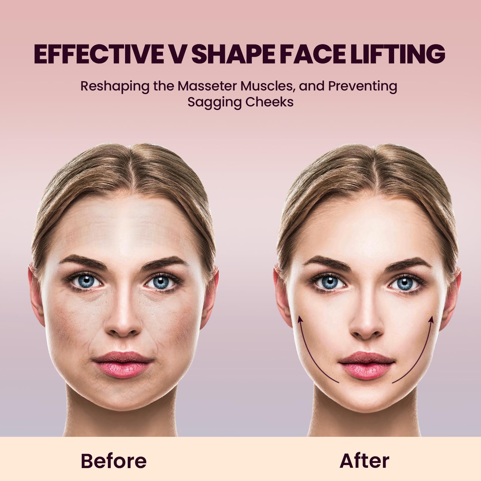 Cteart V-face machine demonstrating jawline sculpting potential.