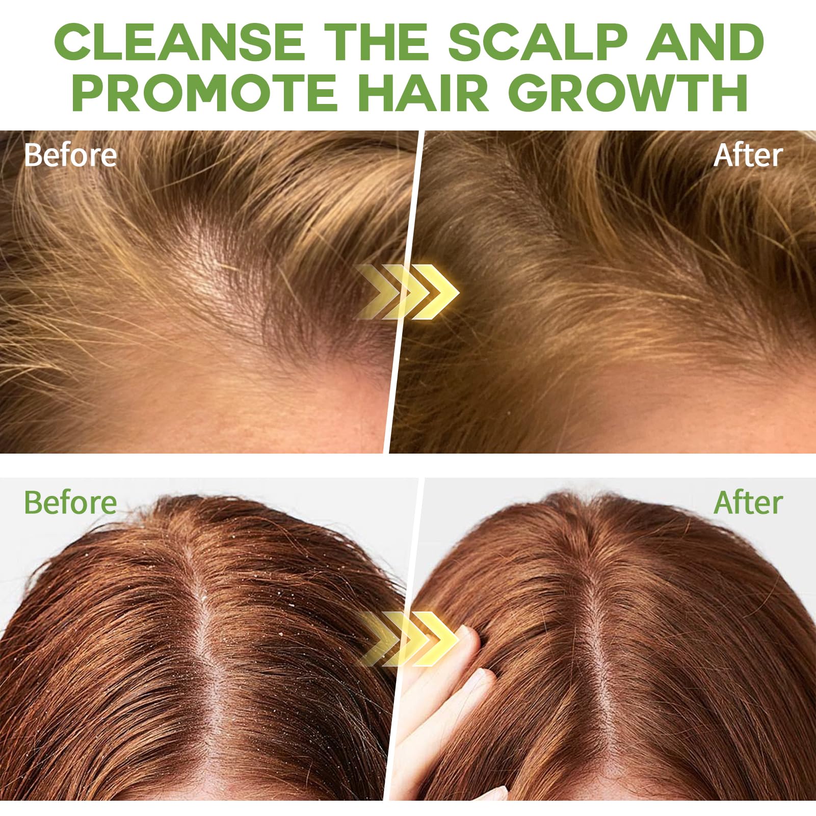 Curlland clarifying-shampoo-foamy-lather close-up showing rich lather and clean roots.