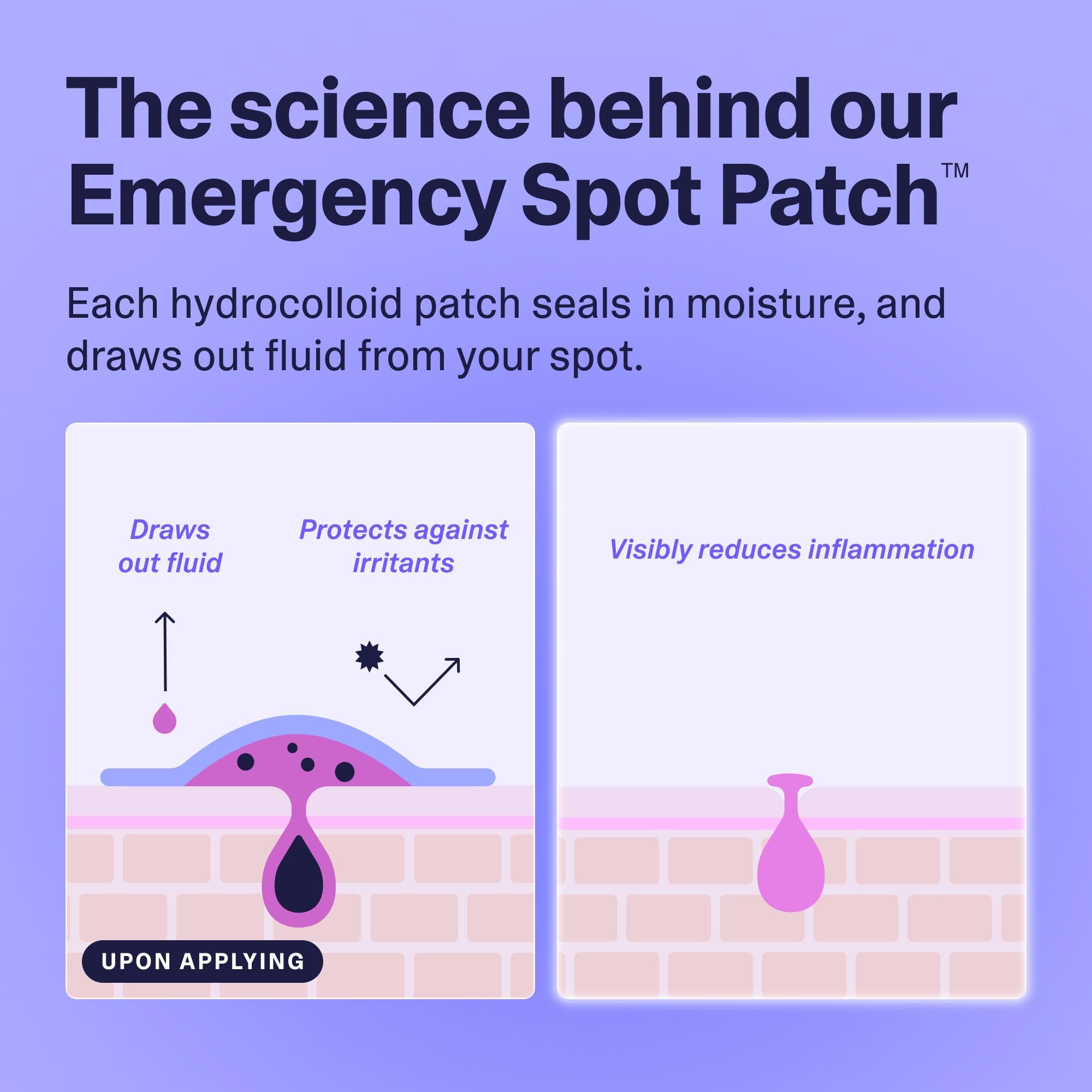 Curology patches applied overnight offer discreet care for blemishes