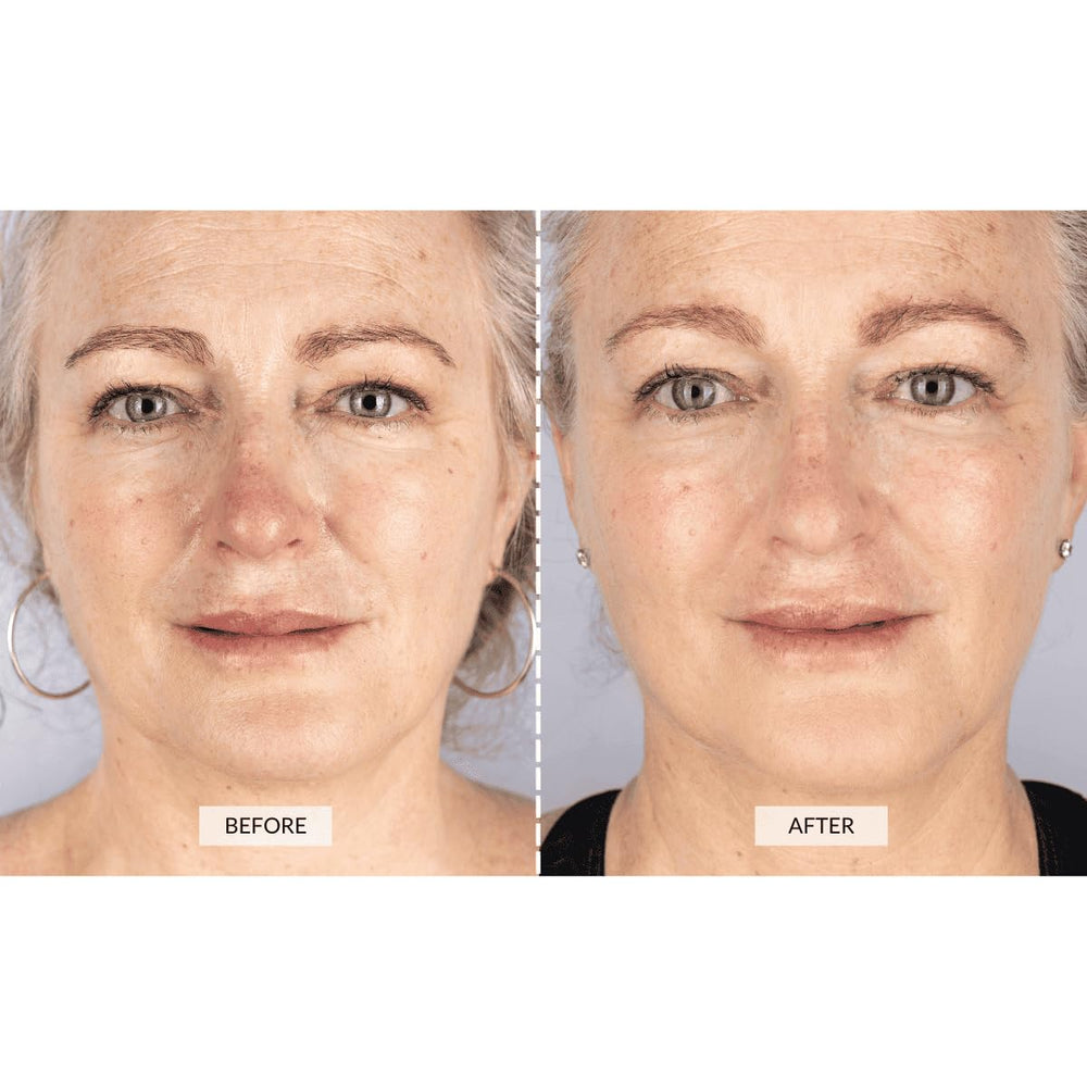CurrentBody pillow technology diffuses light evenly across the skin.