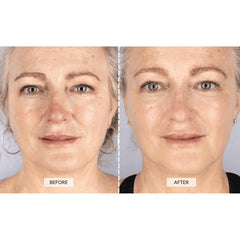 CurrentBody pillow technology diffuses light evenly across the skin.