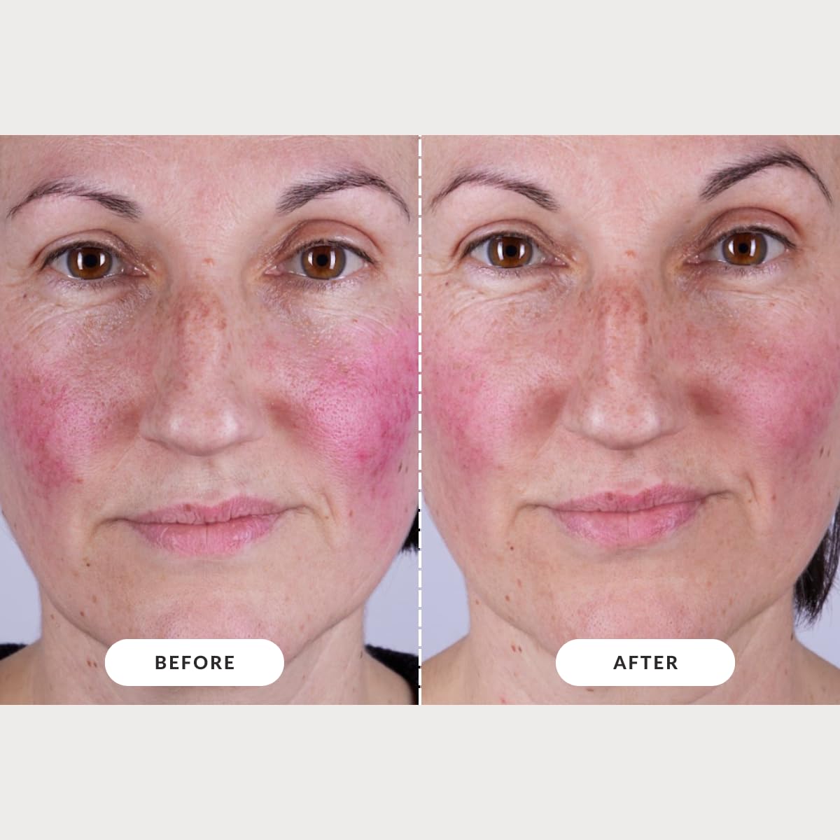 CurrentBody Series 2 glow-ready image showing brighter, even-looking skin tone