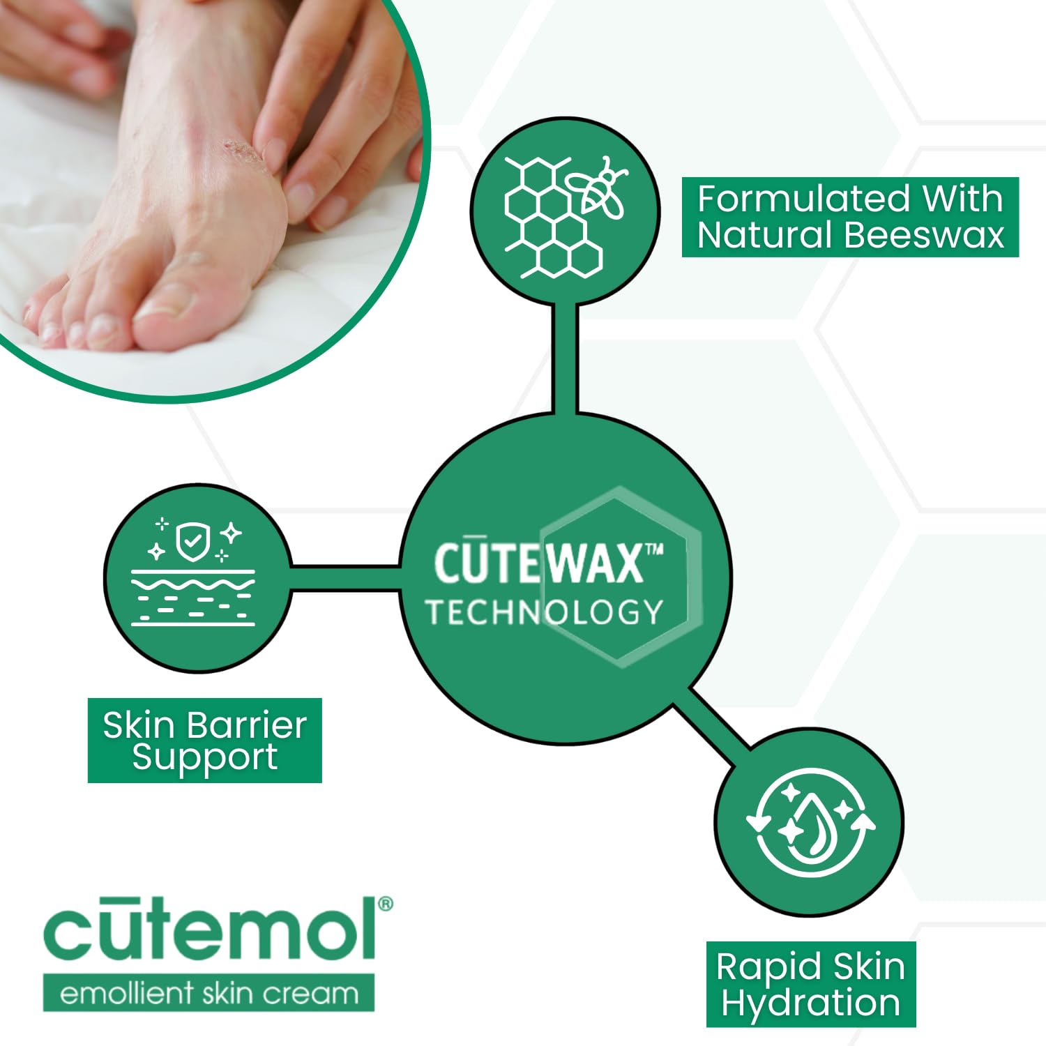 Cutemol Emollient Cream for foot care, softening dry heels and creases.
