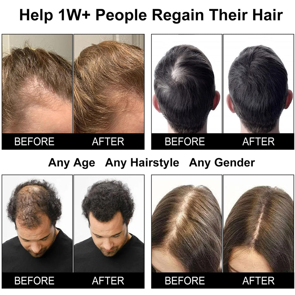 CWTUL Laser Hair Growth Cap packaging with accessories for home-use setup