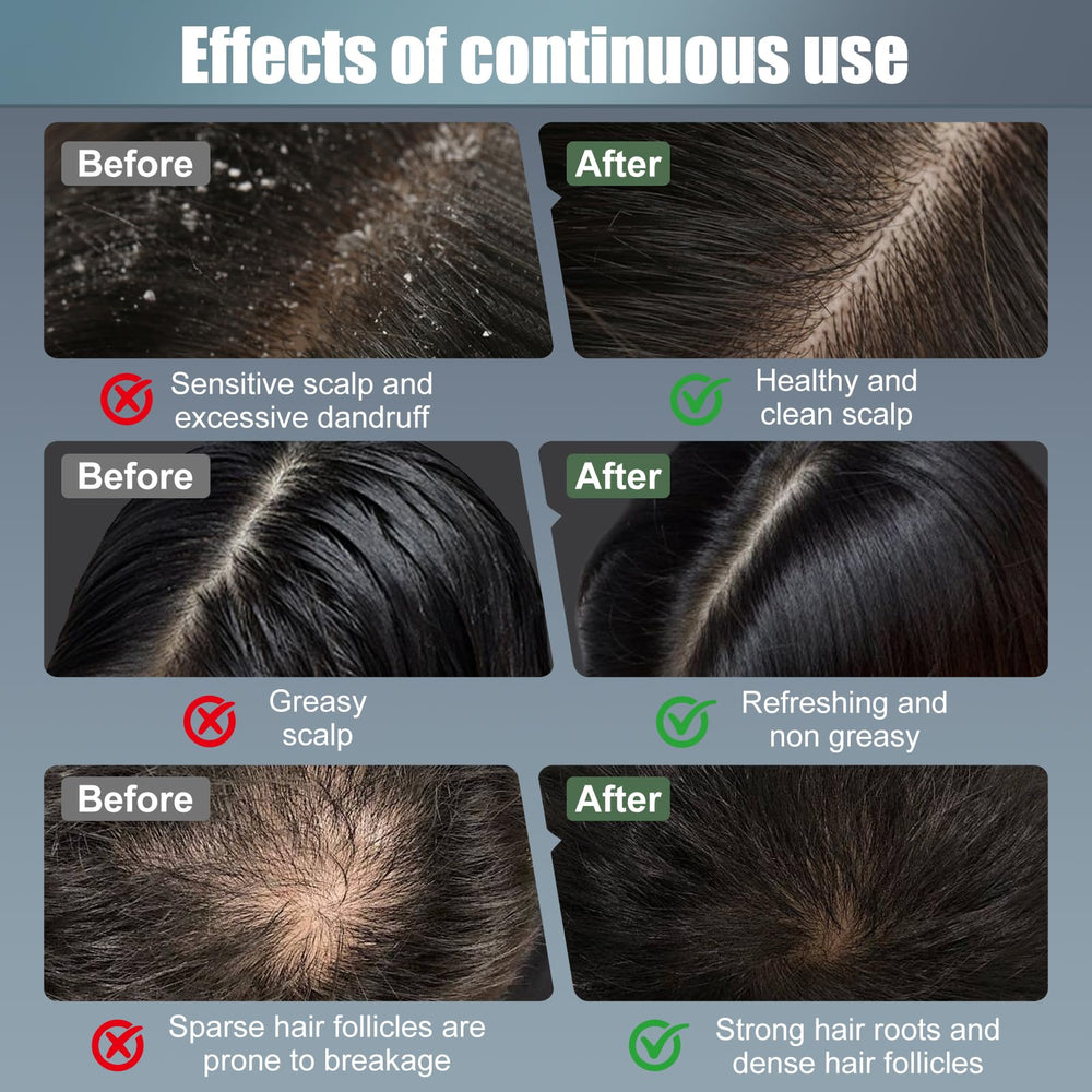 CWTUL Laser Hair Growth Comb top view emphasizes compact, travel-friendly form.