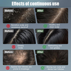 CWTUL Laser Hair Growth Comb top view emphasizes compact, travel-friendly form.