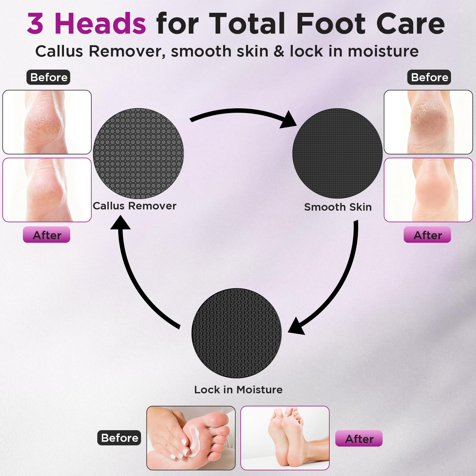 CYFERUY nano glass heads interchangeable for different callus levels