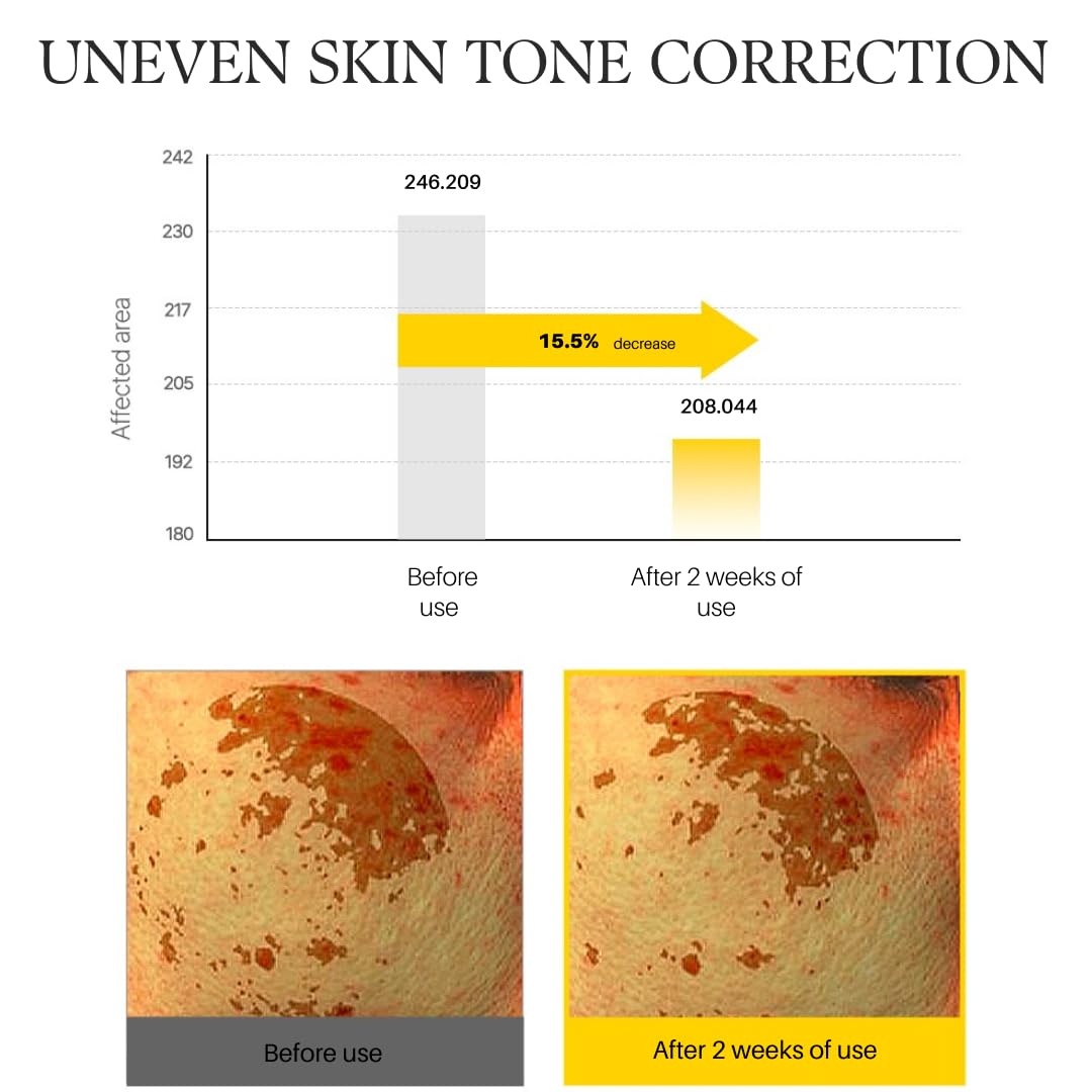 d'alba Piedmont clinical results note improvements in texture and flakiness.