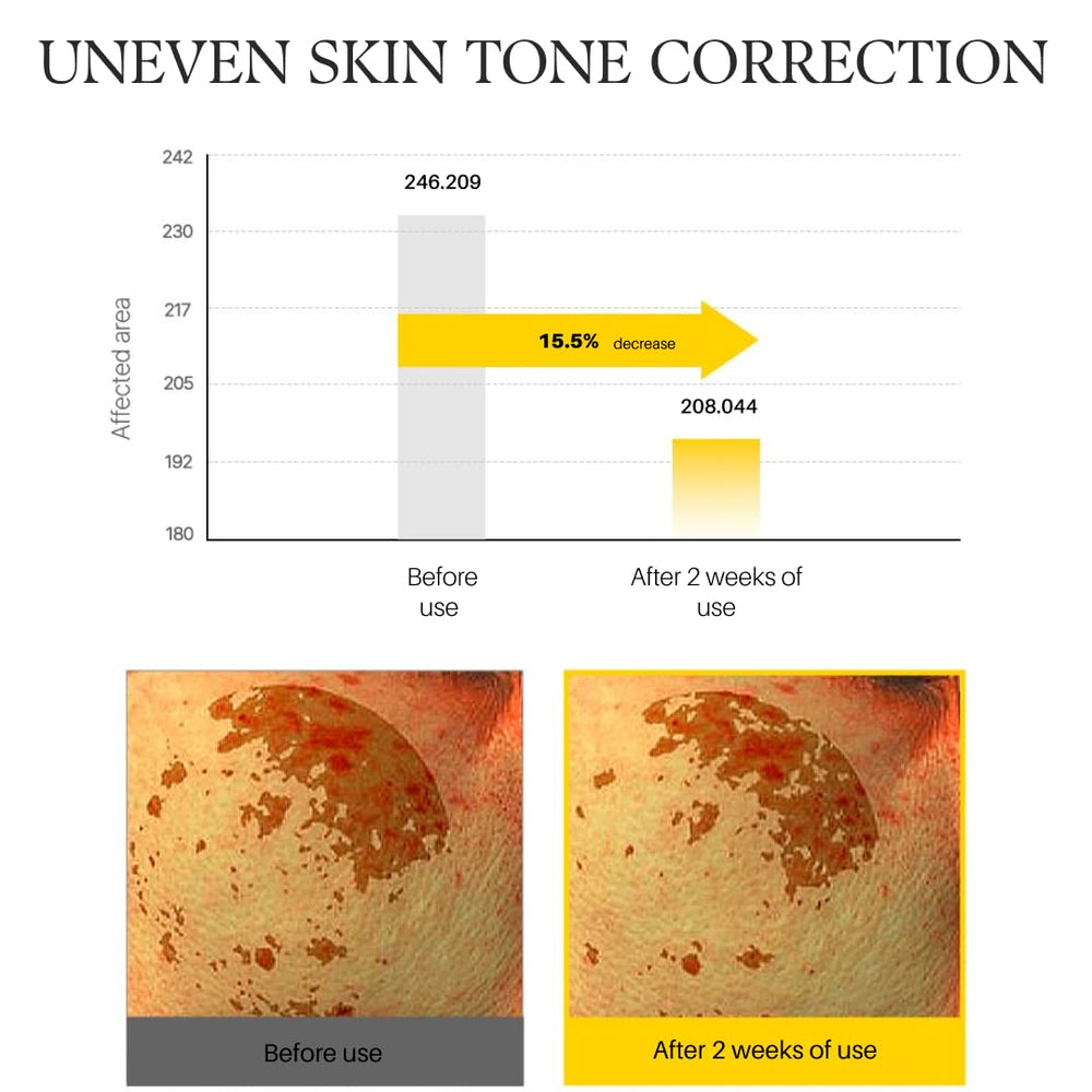 d'alba Piedmont clinical results note improvements in texture and flakiness.
