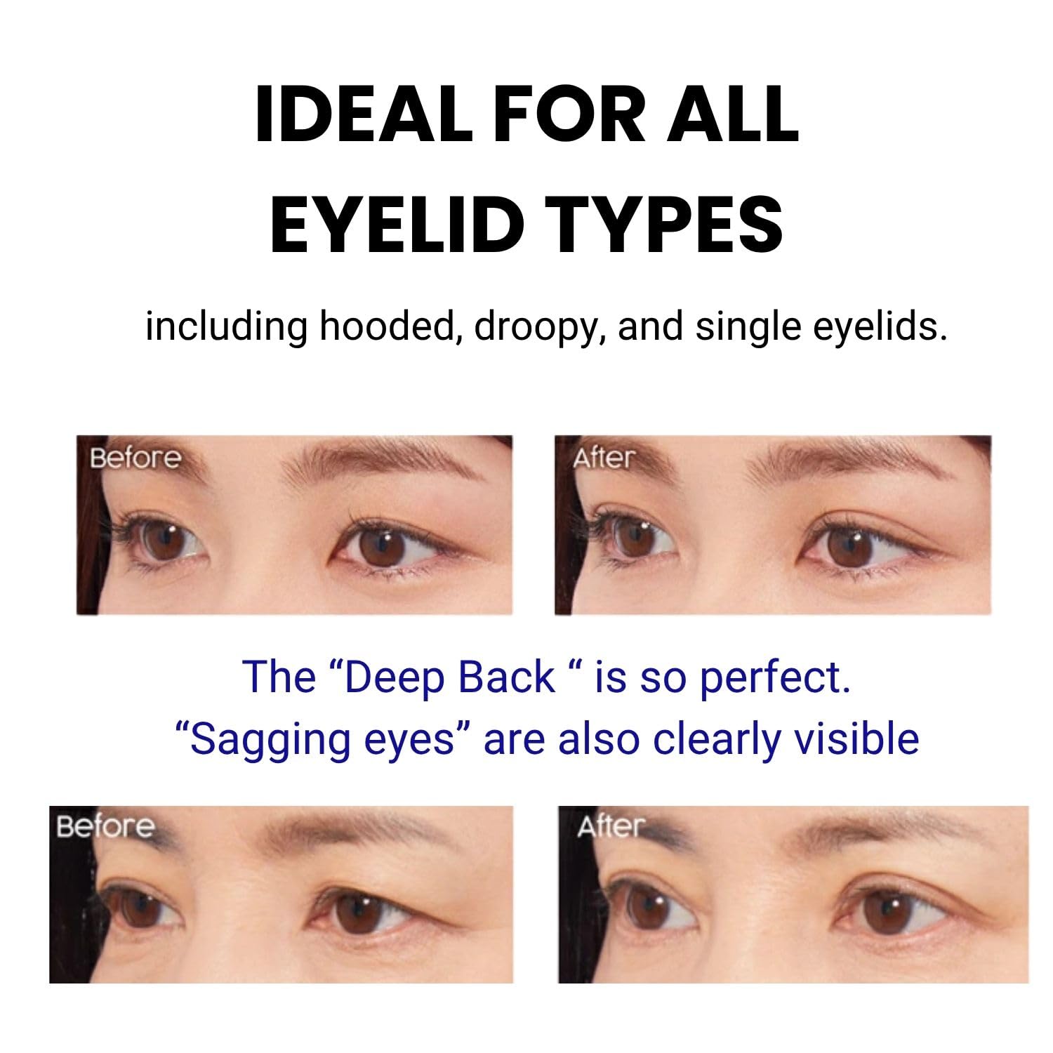 D-UP waterproof eyelid tape stays secure for all day wear in humidity.