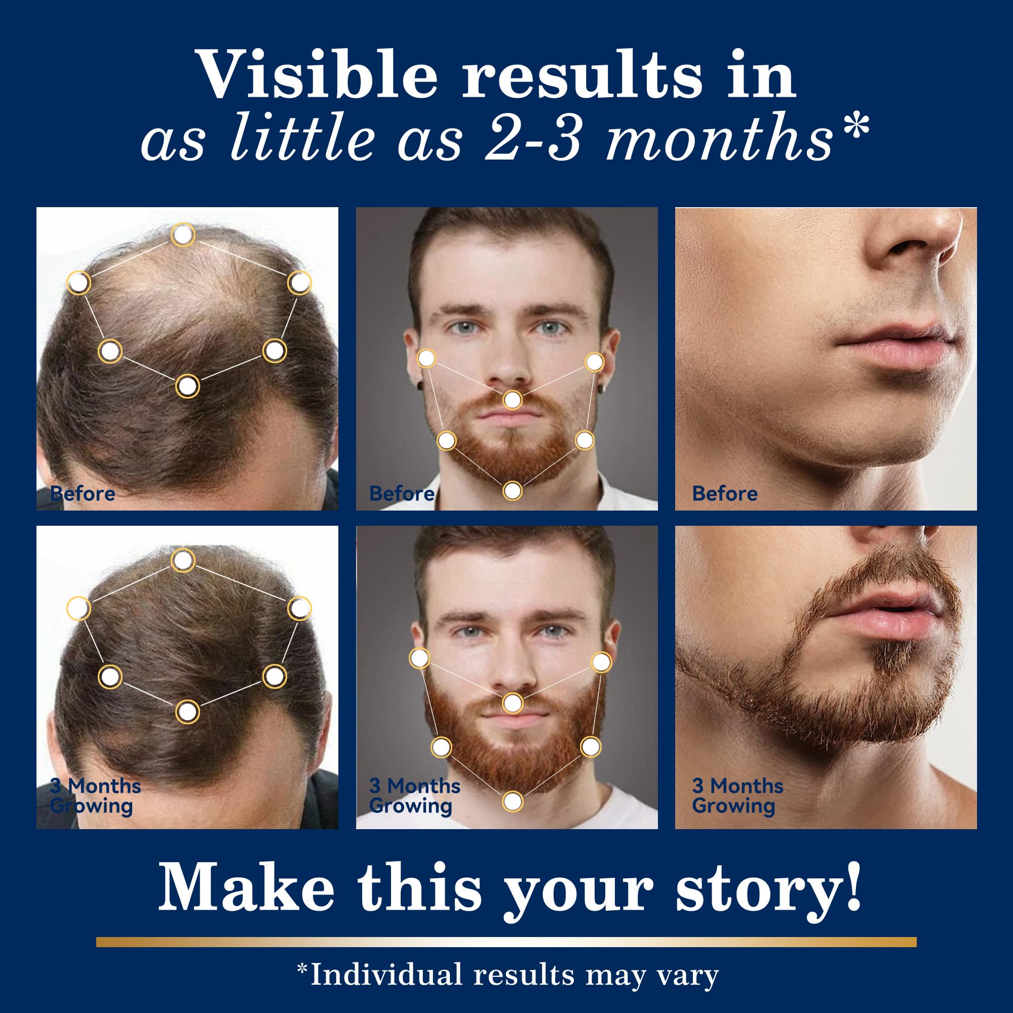 DAAZZS Minoxidil scalp closeup showing thinning areas