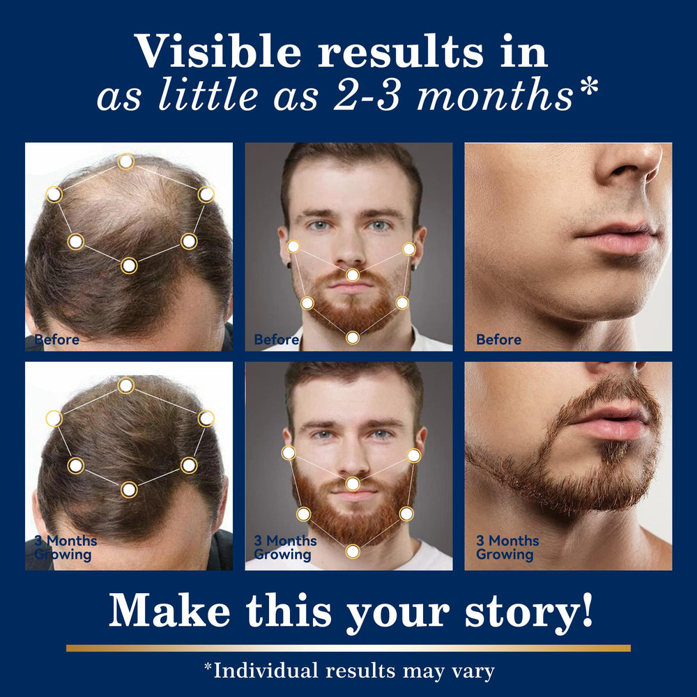 DAAZZS Minoxidil scalp closeup showing thinning areas