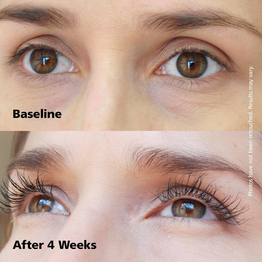 Dabalash-closeup-lash-growth reveals lash hair with potential length and density.