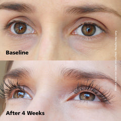 Dabalash-closeup-lash-growth reveals lash hair with potential length and density.