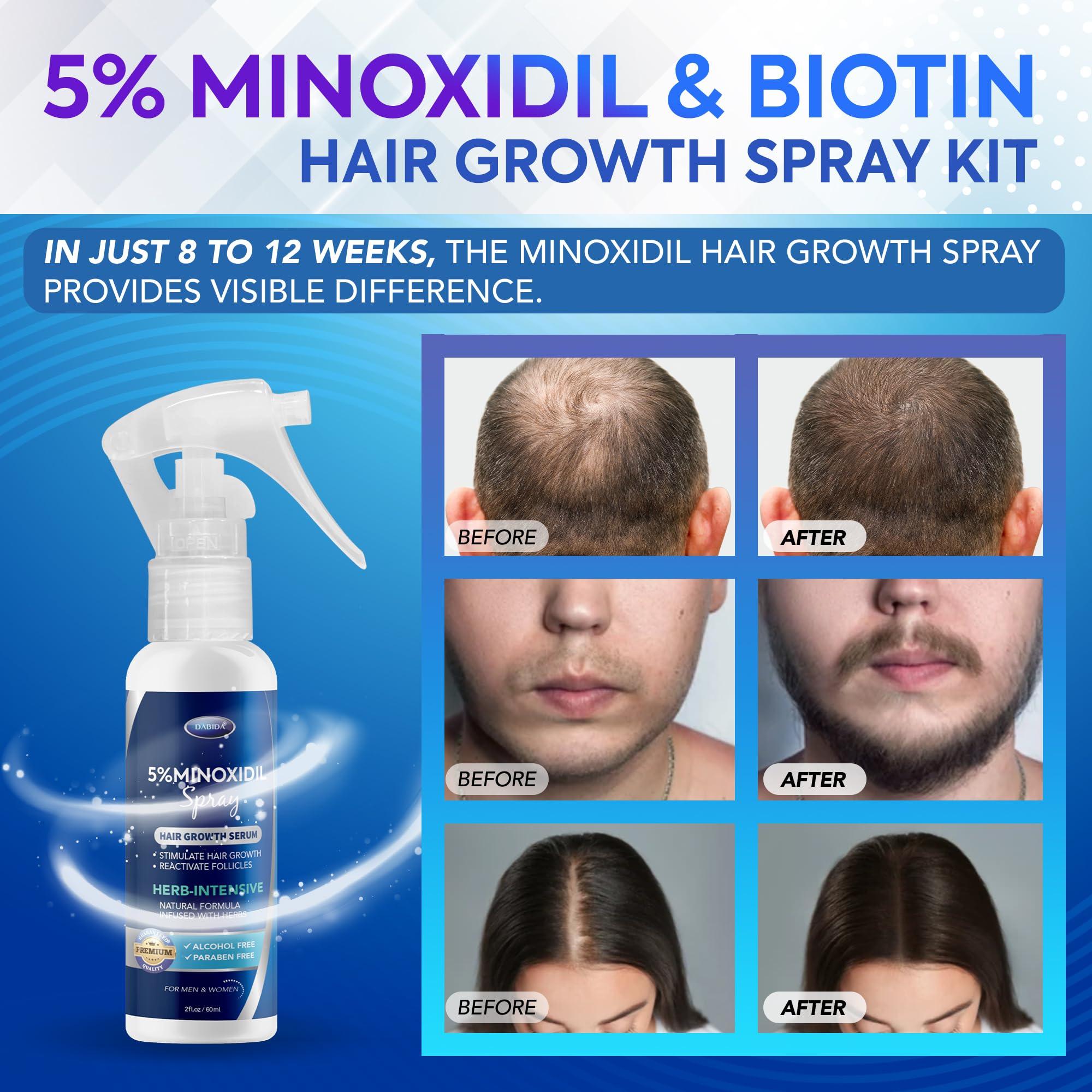DABIDA minoxidil spray application demonstrates easy daily use.
