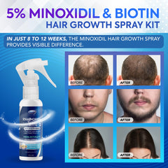 DABIDA minoxidil spray application demonstrates easy daily use.