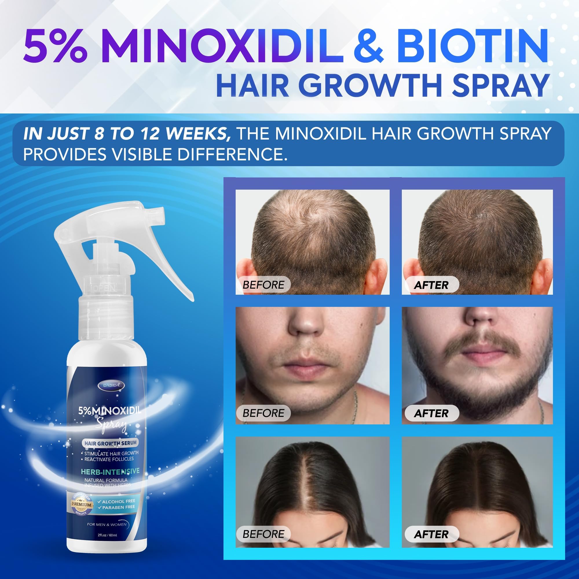 DABIDA Minoxidil women application showcases easy at-home growth routine.