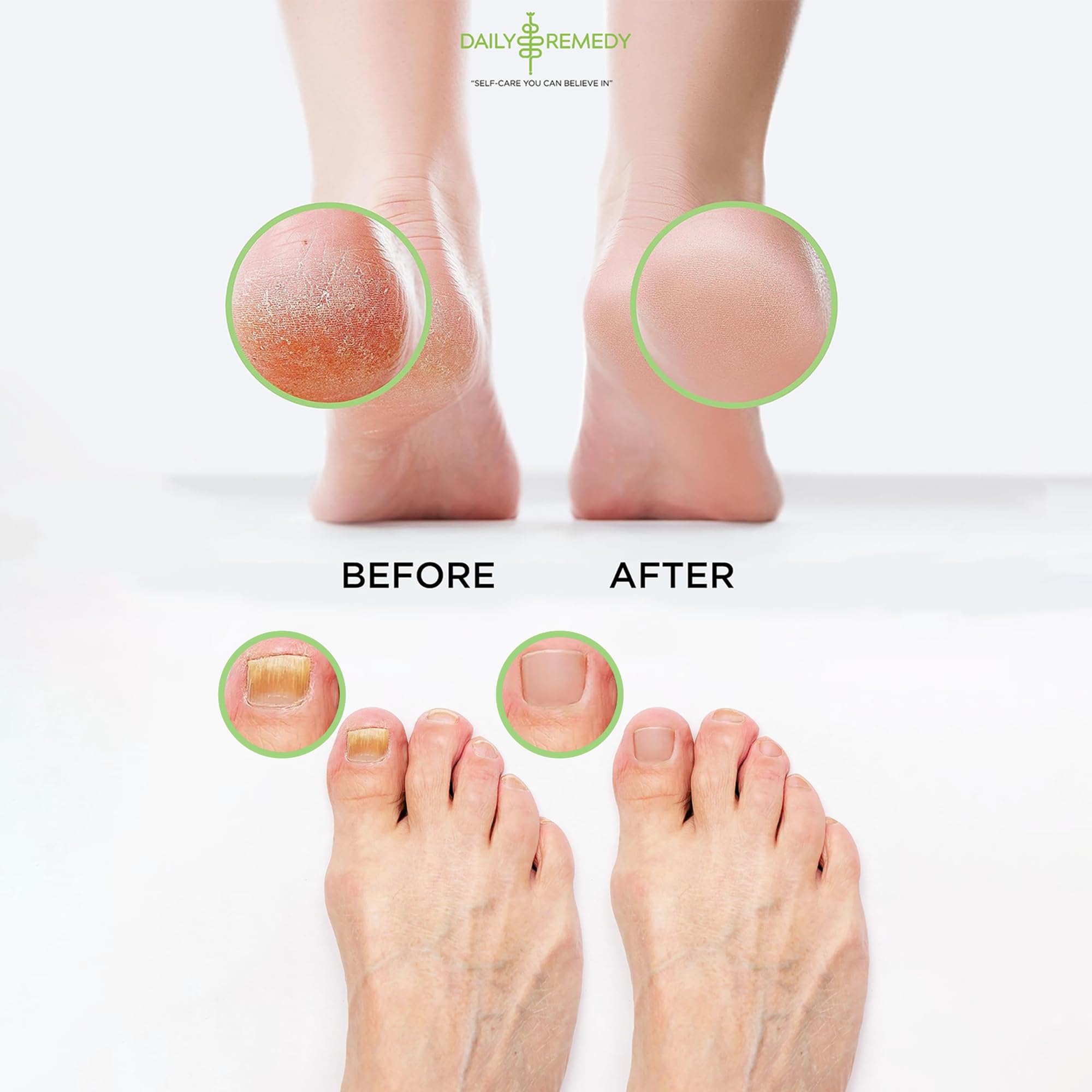 Daily Remedy foot soak with Epsom salts eases soreness.