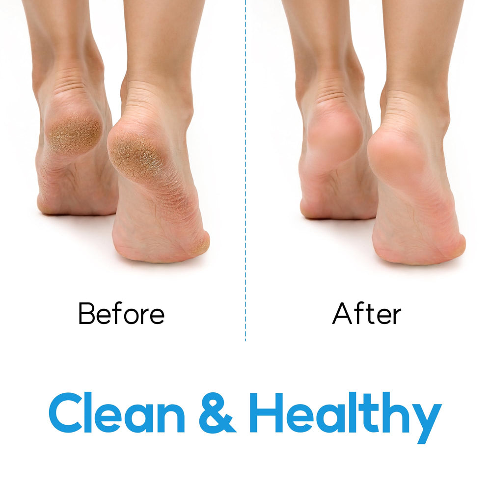 DalkomLife foot scrubber supports odor control when paired with wash and tea tree oil