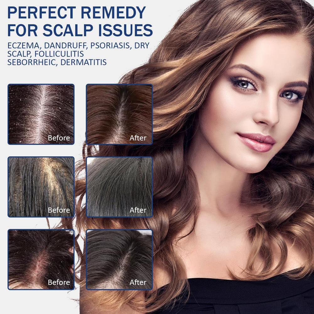 Danliss packaging design highlights sulfate-free, hypoallergenic formula for sensitive scalps.
