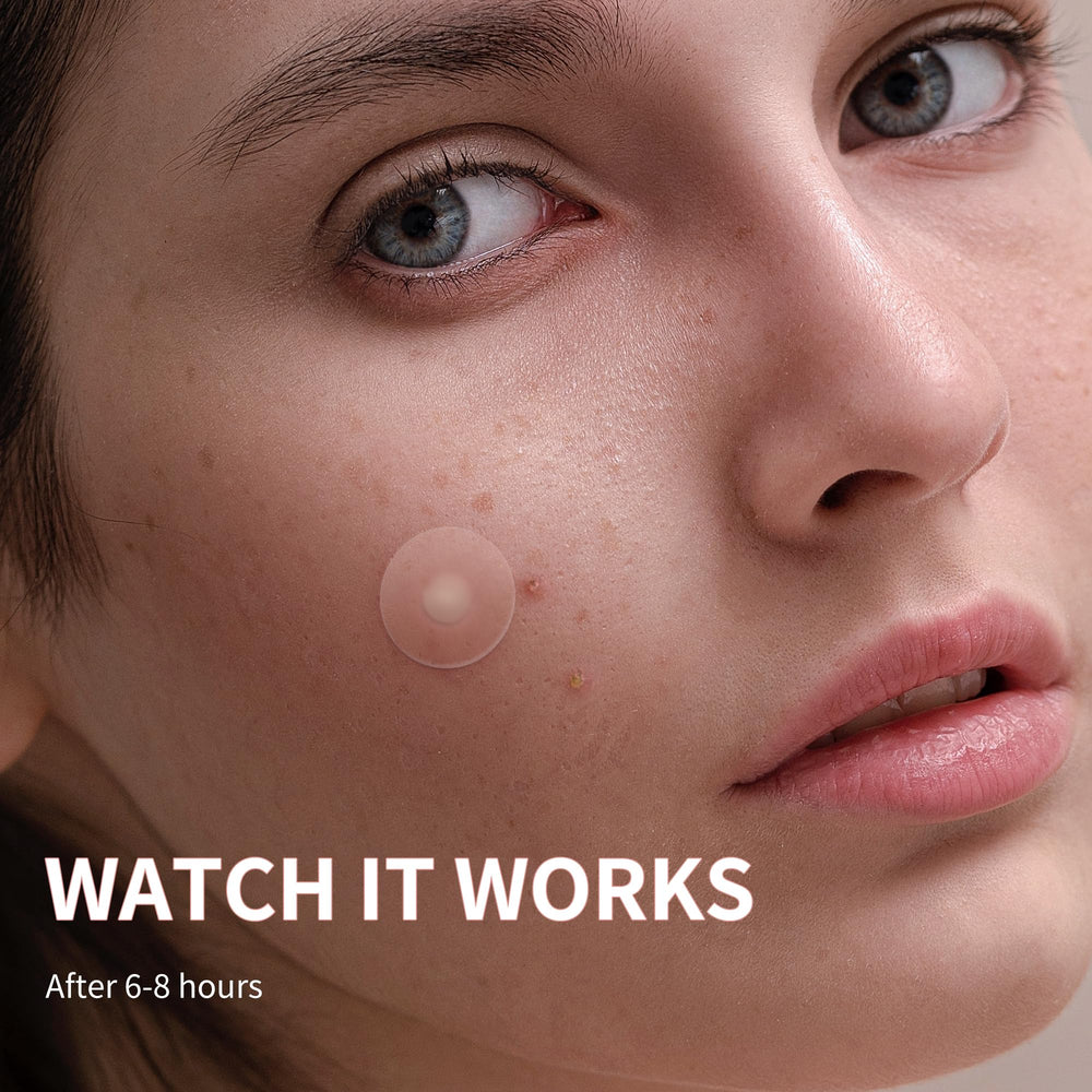 Daolyo patch with calendula oil highlighted for soothing blemish care