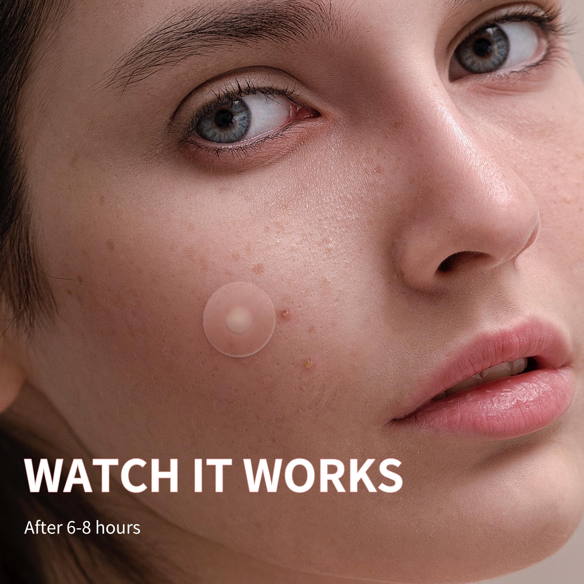 Daolyo patch close-up highlighting salicylic acid action on impurities and spot clarity.