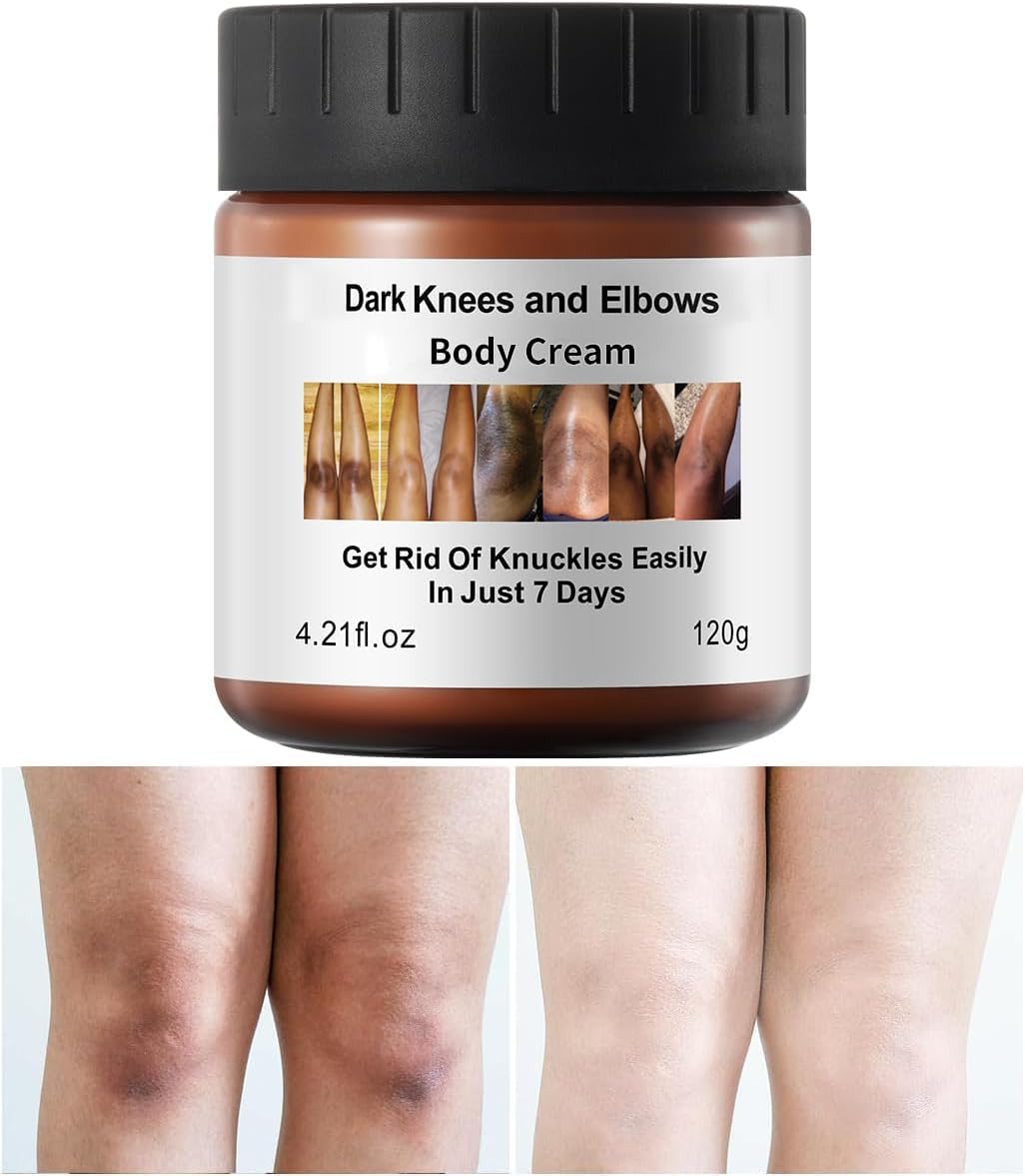 Dark Knees Remover bottle front showing premium cream for skin hydration.