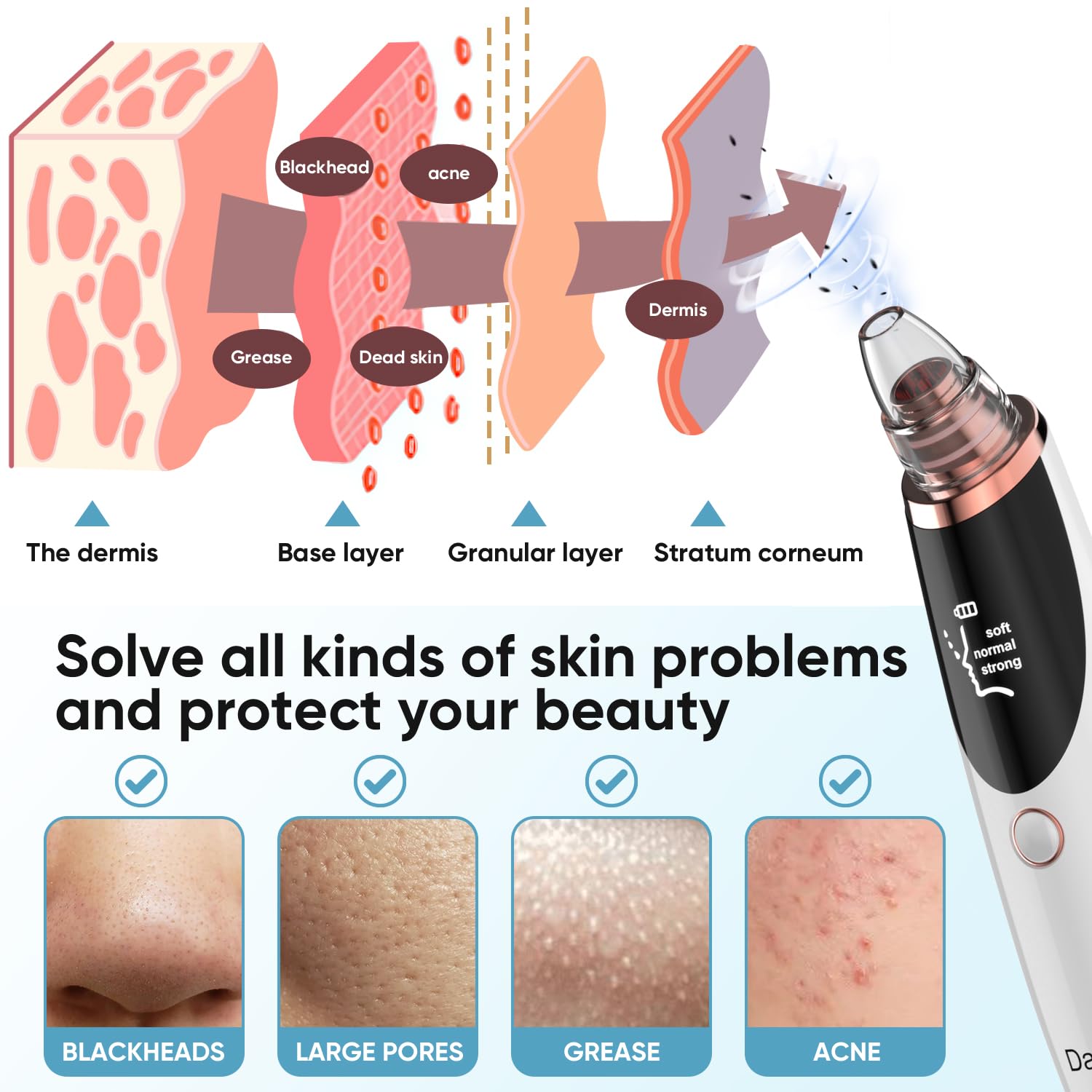 Daweir blackhead remover nose spot targets stubborn blackheads with safe, gentle suction