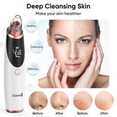 Daweir pore vacuum usage step demonstrates adjustable suction for personalized skin care