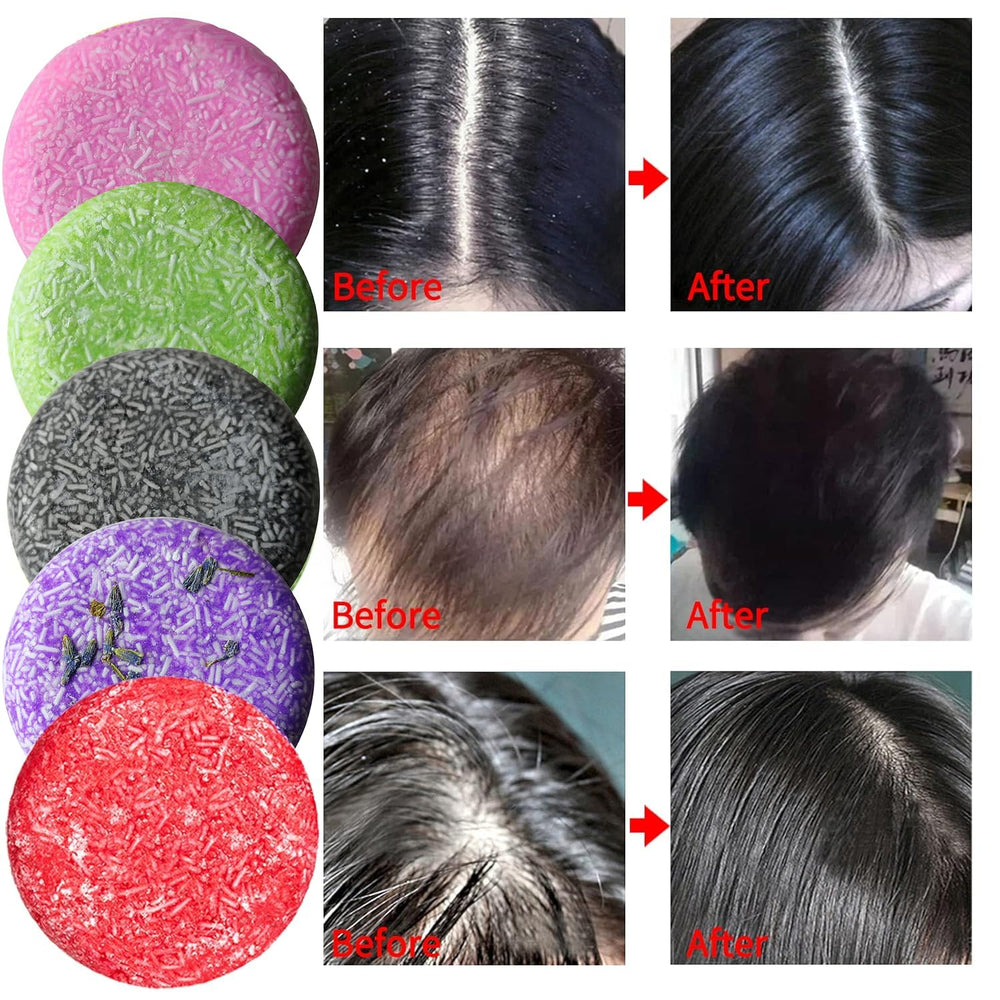 DBEAUTYM olive oil and shea butter bar nourishes and moisturizes dry hair.