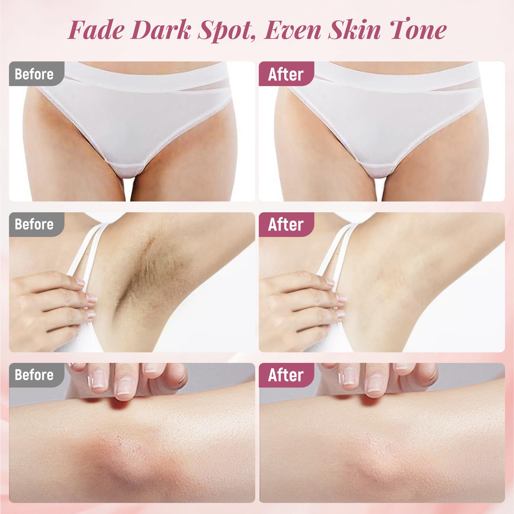 DCSCRK Skin Lightening Cream applied to inner thigh area for even tone and moisture.