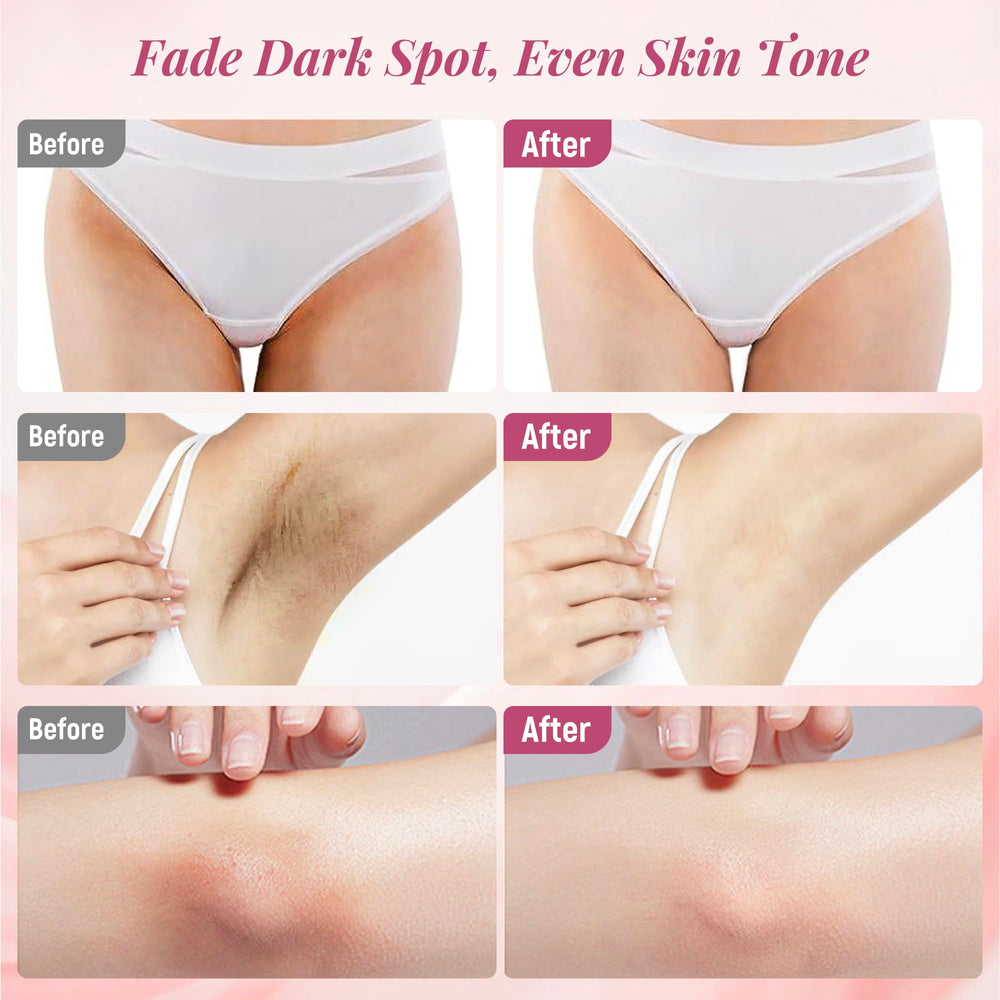 DCSCRK Skin Lightening Cream applied to inner thigh area for even tone and moisture.