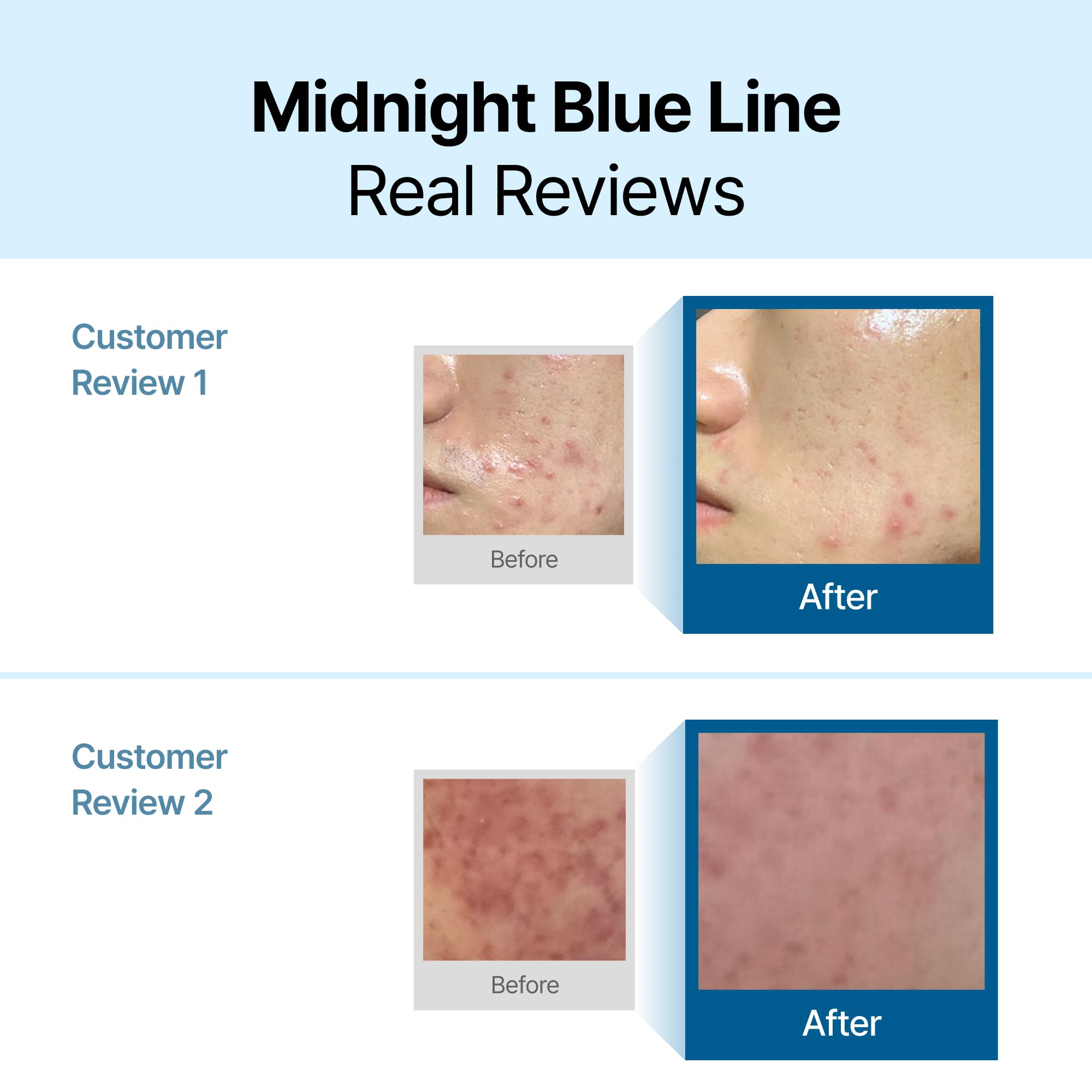 DearKlairs Midnight Blue Calming Cream ingredients showcase guaiazulene and centella for soothing care.
