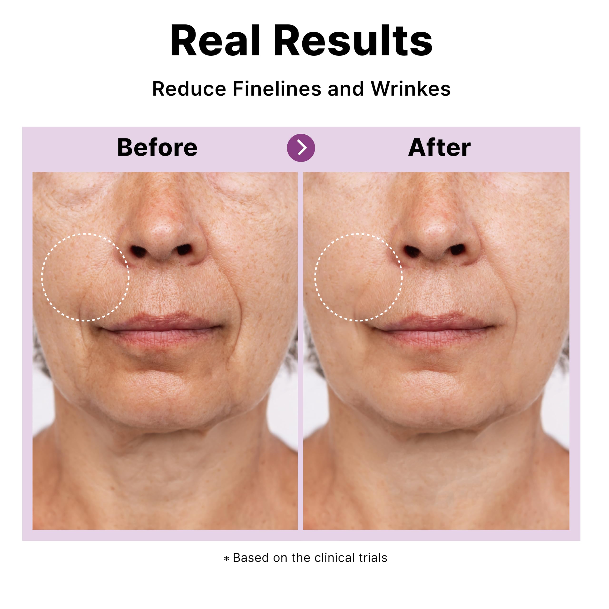 DearMYDEW serum being applied to skin for firming effect