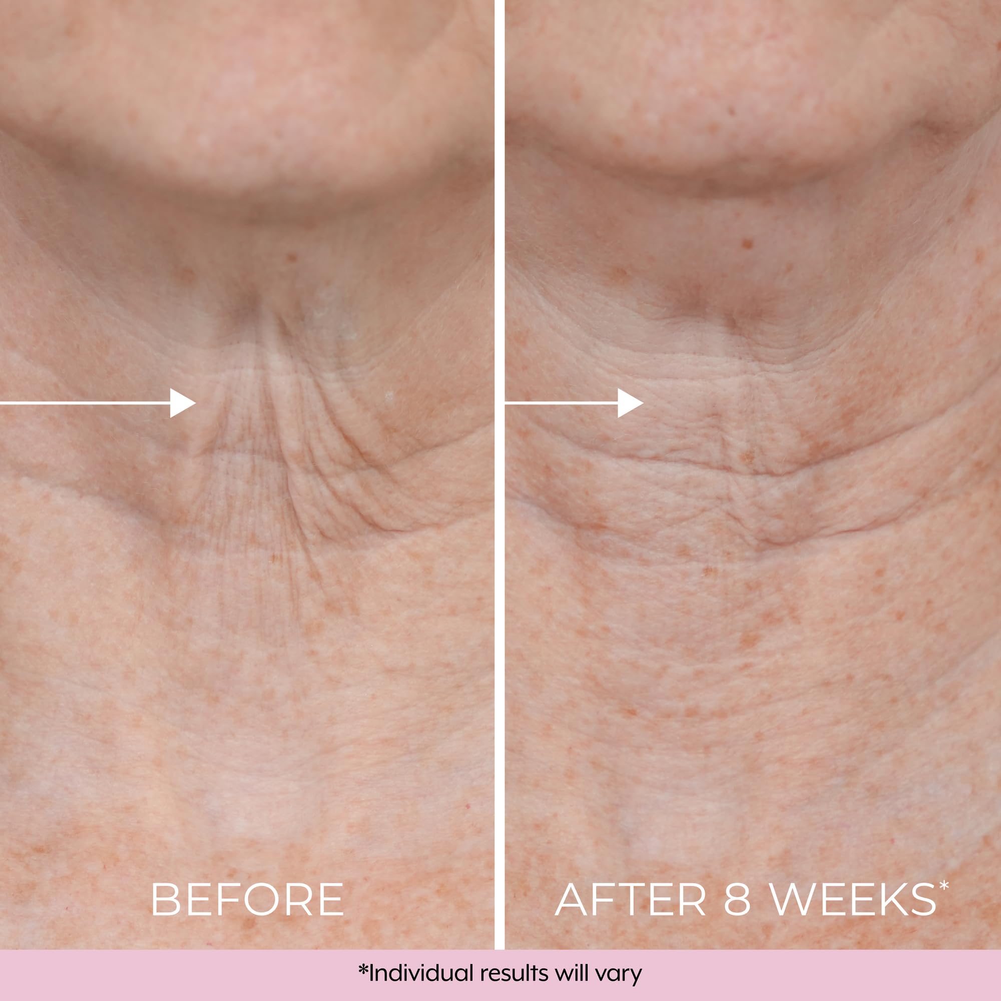 Dekliderm Neck Firming Cream dermatologist tested — safe for all skin types.