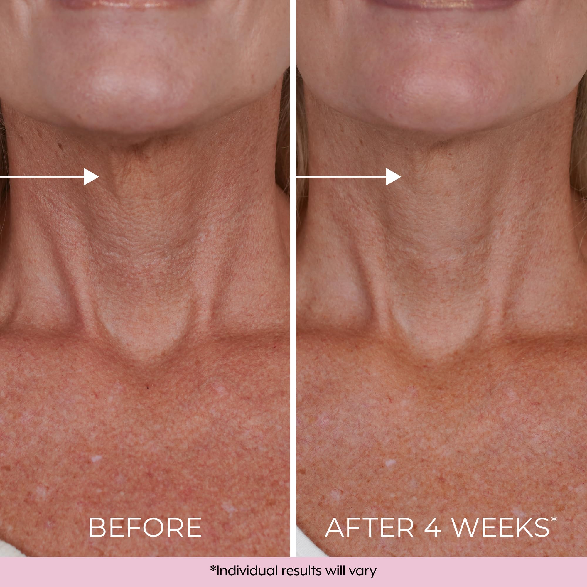 Dekliderm Neck Firming Cream night ritual emphasizing soothing texture during use.