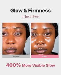 Delere Caviar Glow mask application promises quick glow and refined pores.