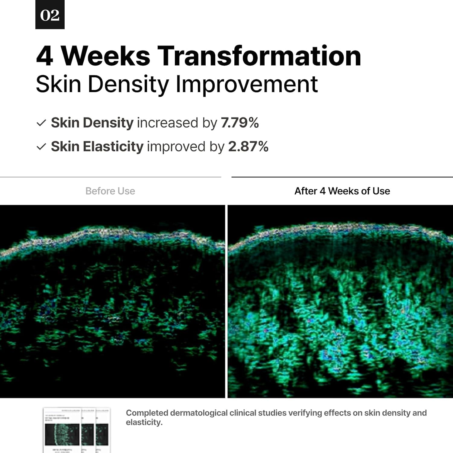 DEMAR 3 Signature ESTUD spa-use scene hints at professional pore care.