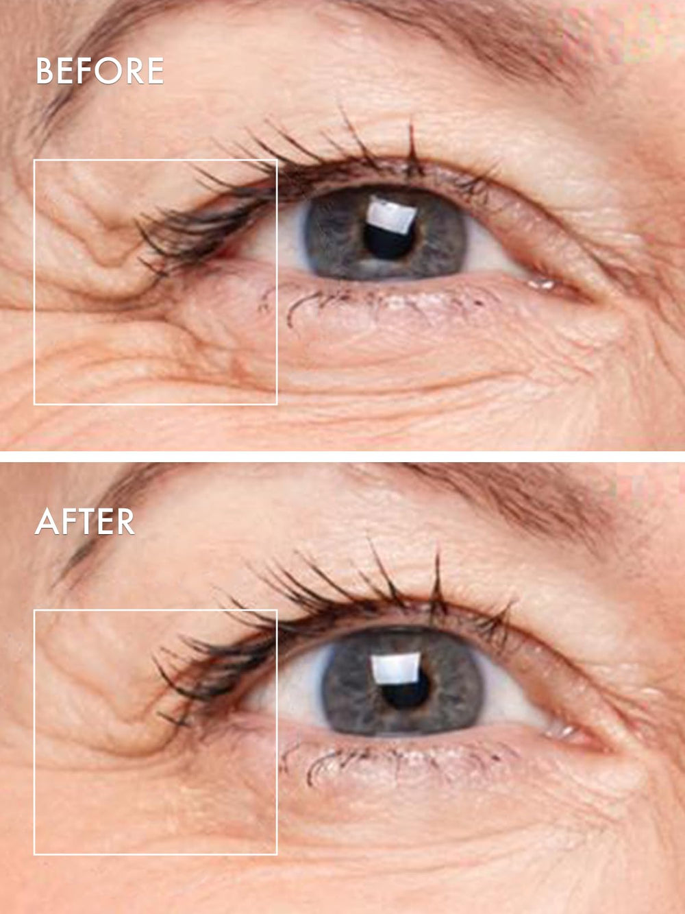 Depology hydration-boost image shows skin looking plump and refreshed after use