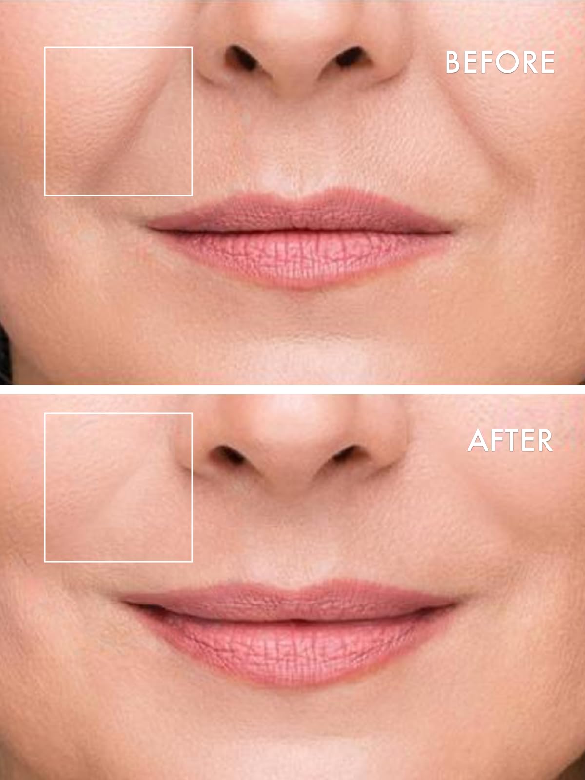 Depology peptides and amino acids image emphasizes advanced skin-supporting ingredients
