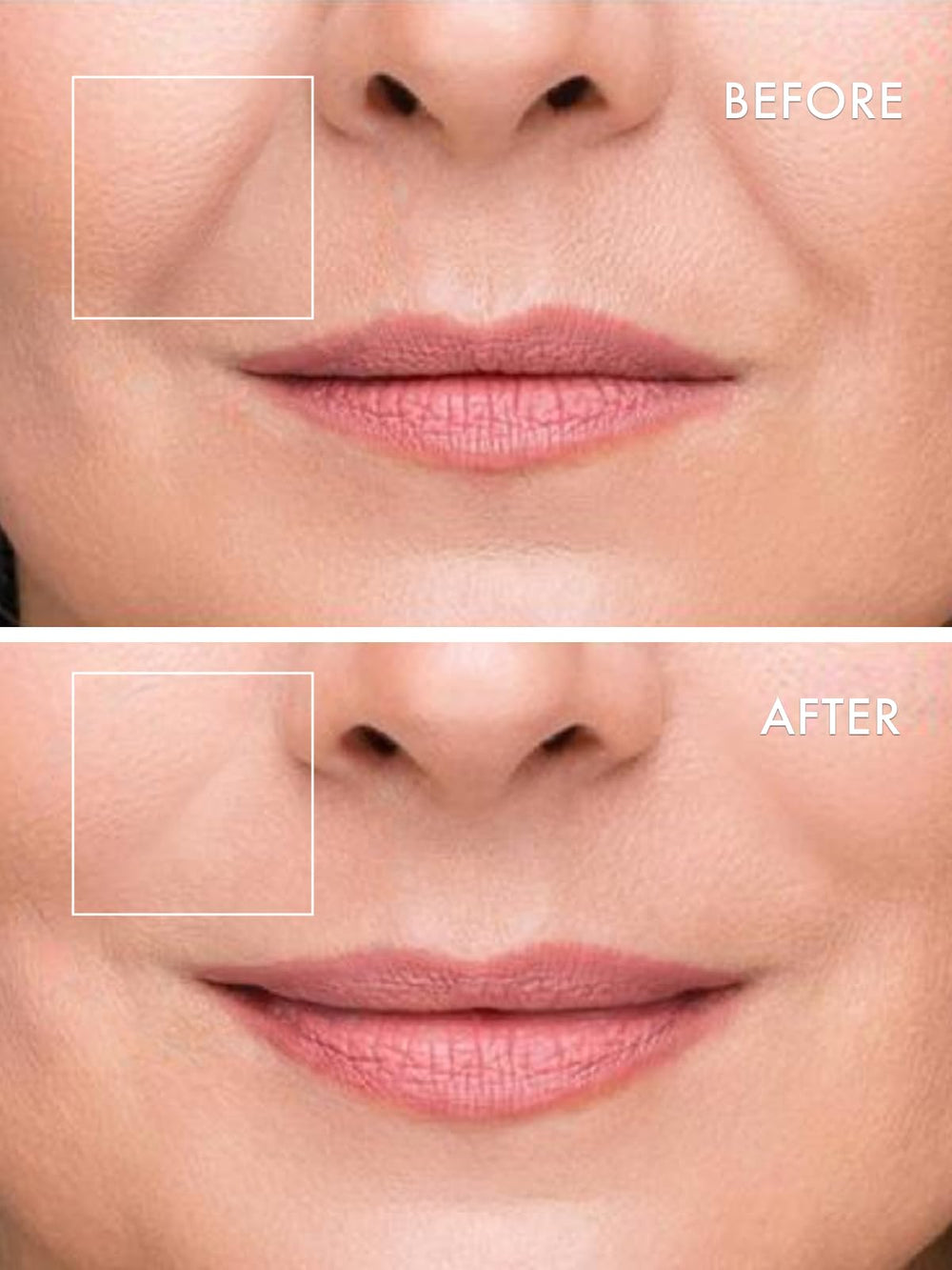Depology peptides and amino acids image emphasizes advanced skin-supporting ingredients