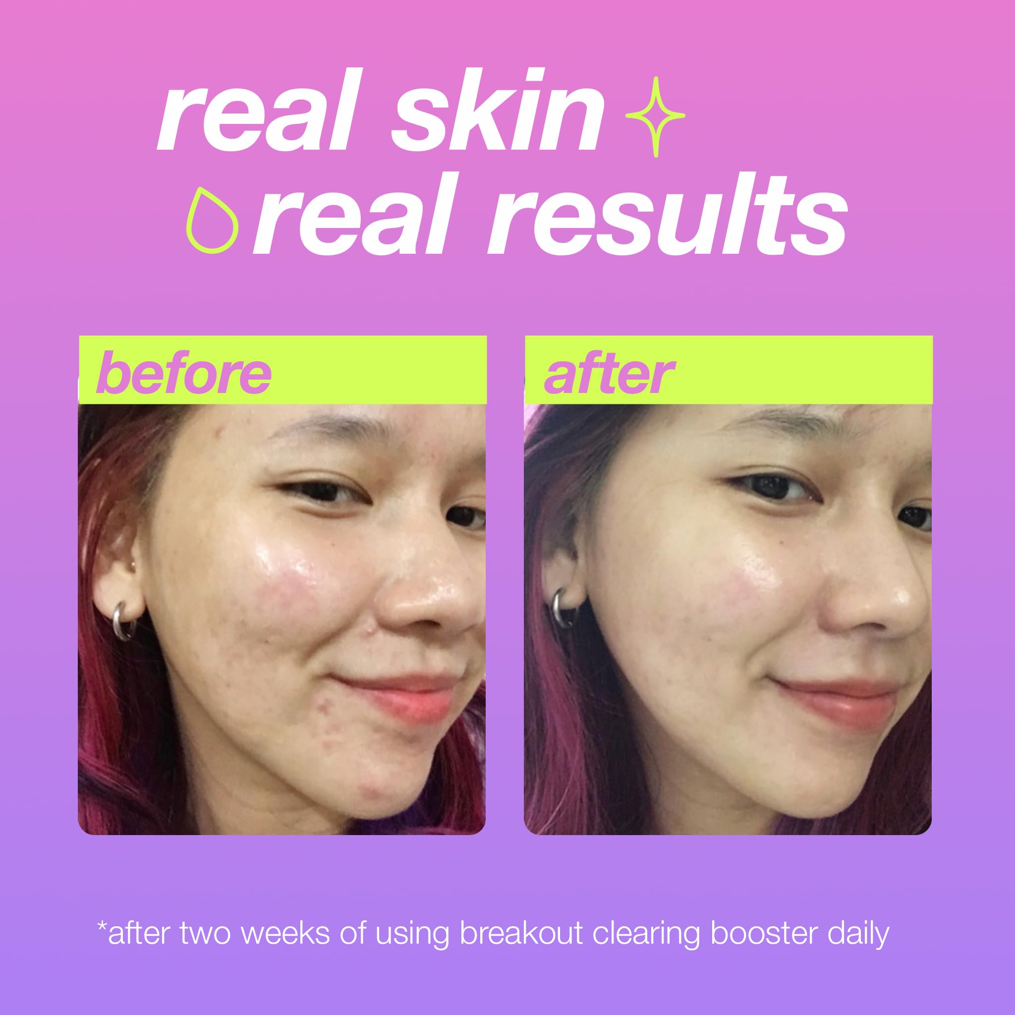 Dermalogica Clear Start Niacinamide ingredient close-up emphasizes tone-evening benefits.
