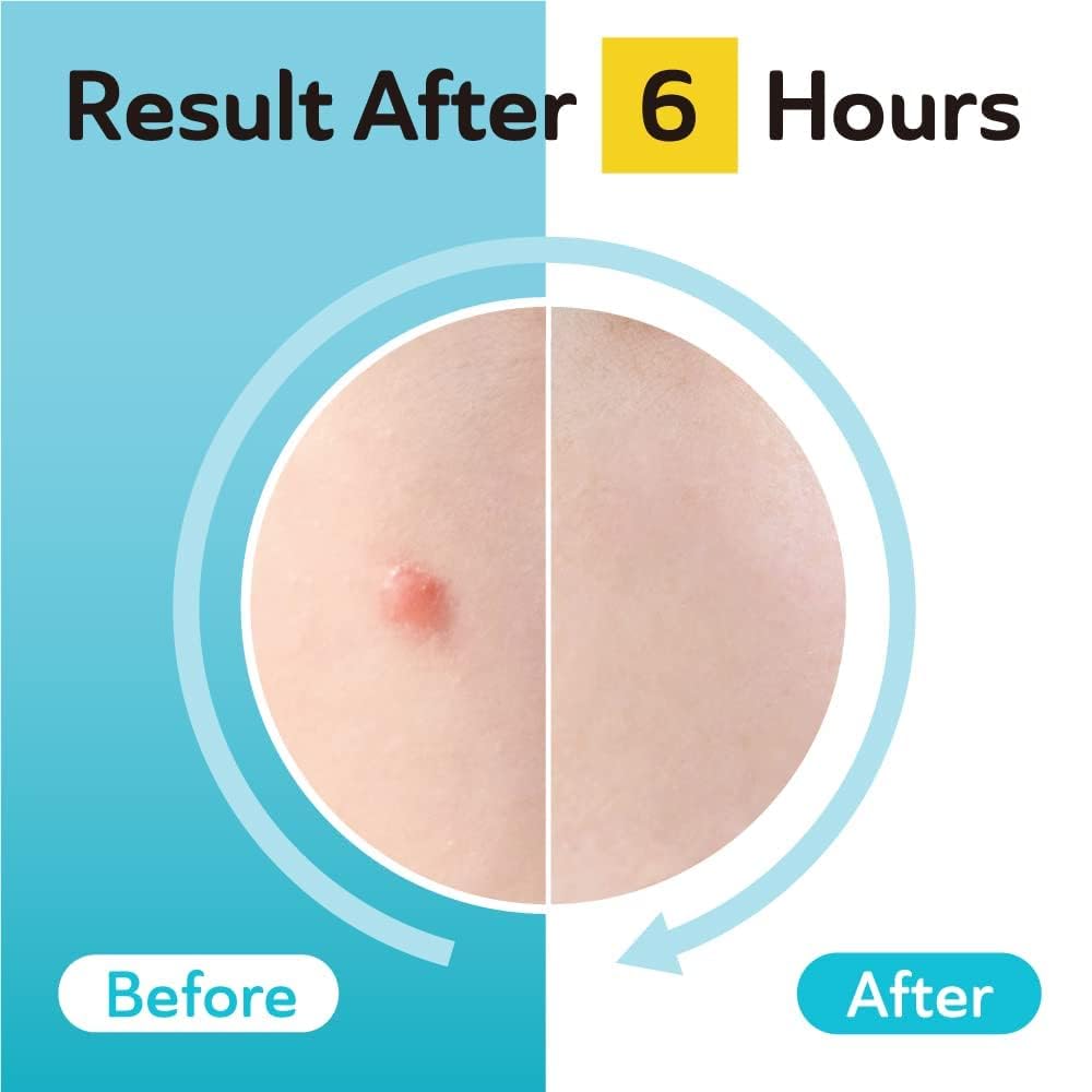 DERMA ANGEL night use patch suitable for overnight care